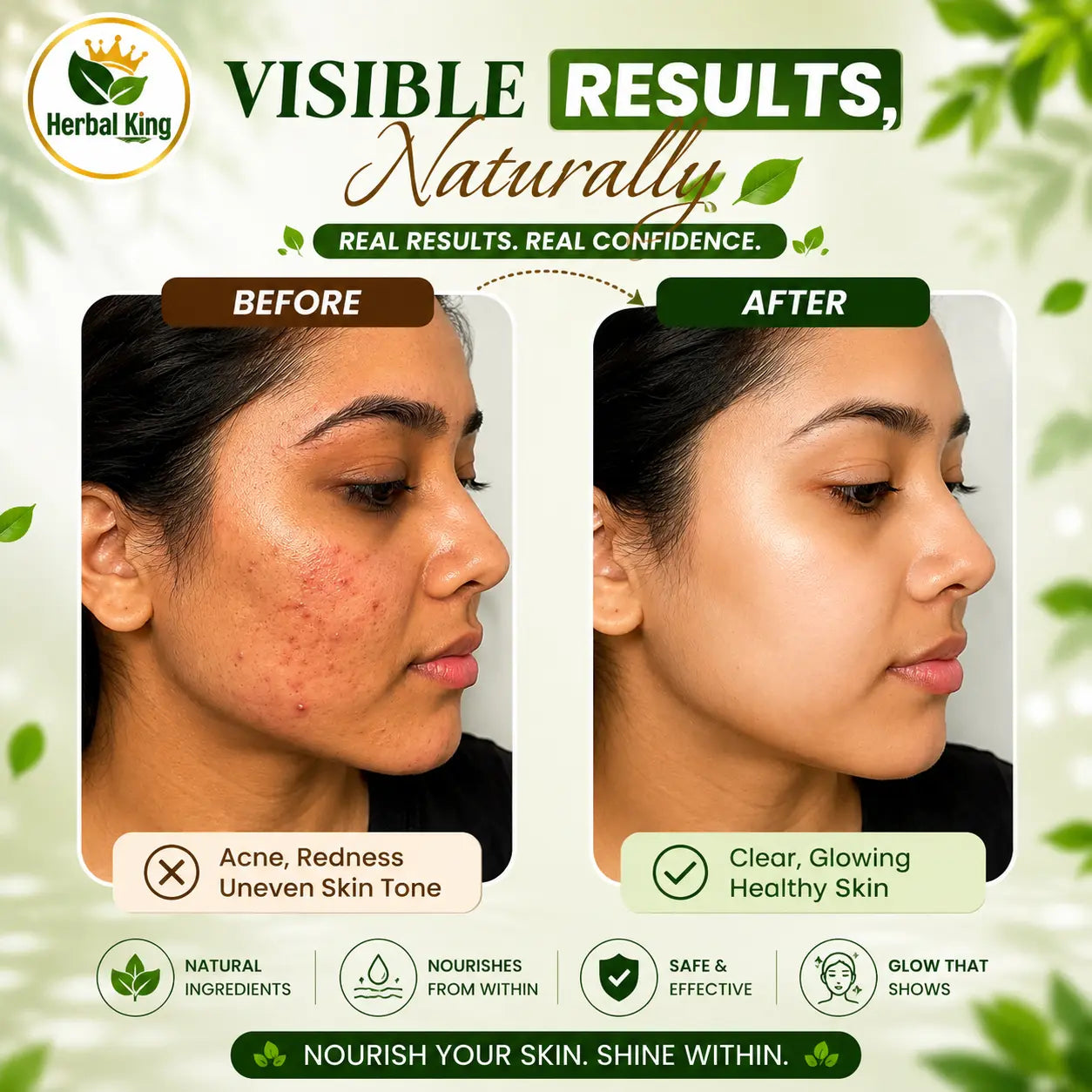 Herbal King Skin Glow Pro Effervescent Tablets for Men & Women